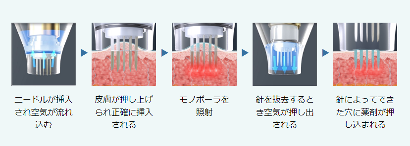 薬剤を均一に浸透させるから