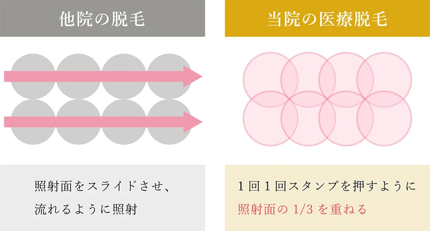 万全な打ち漏れ対策と技術の研鑽