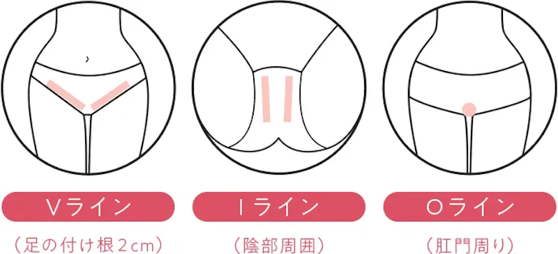 介護脱毛の範囲について