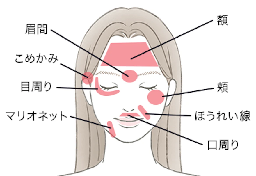 レスチレン®のおすすめの注入箇所