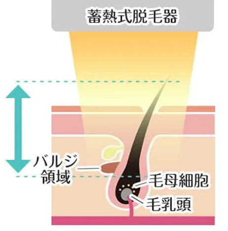 蓄熱式