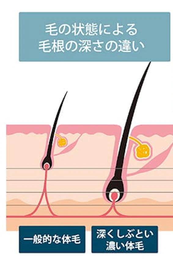 ヒゲは密度が濃く太いから