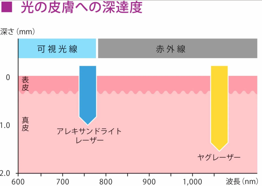 顔や背中の産毛にも対応できる