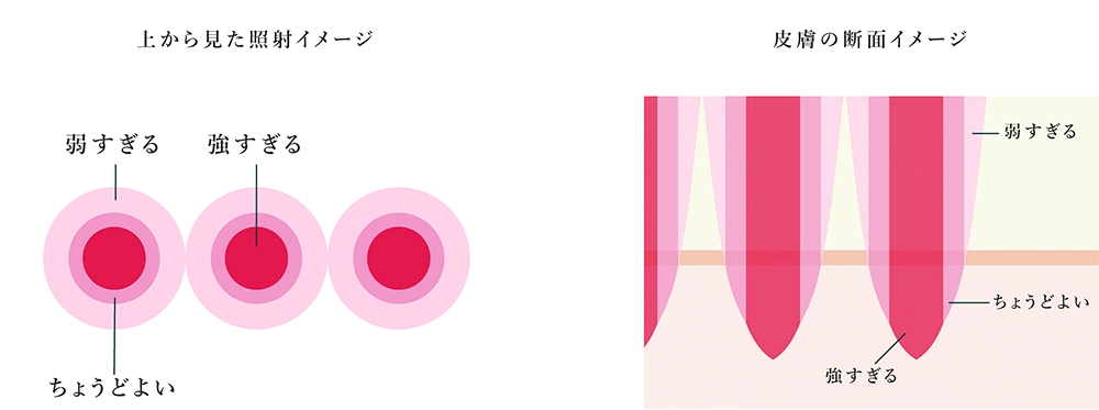 通常のレーザー光(ガウシアン型)