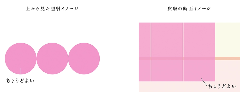 当院のレーザー光(トップハット型)