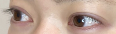 Before画像