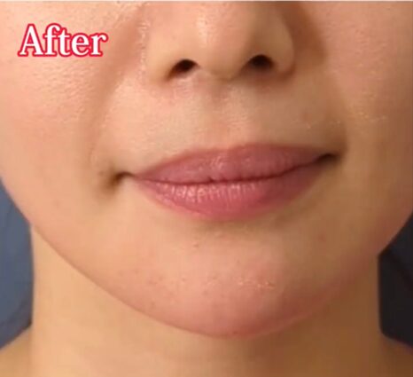 After