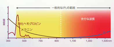 一般的なIPL