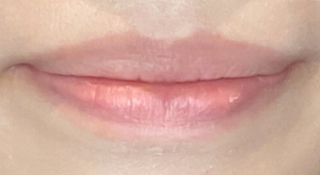 Before画像
