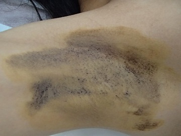 Before画像