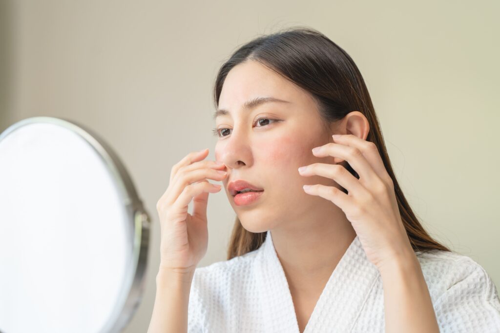 赤ら顔のよくある質問