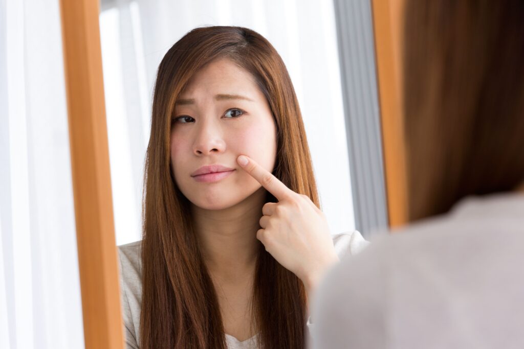 ほうれい線のよくある質問