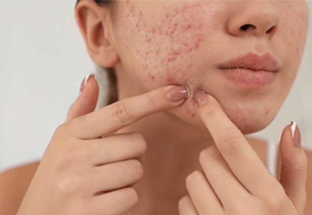 サブシジョンで失敗しないために！後悔を防ぐ3つのポイント