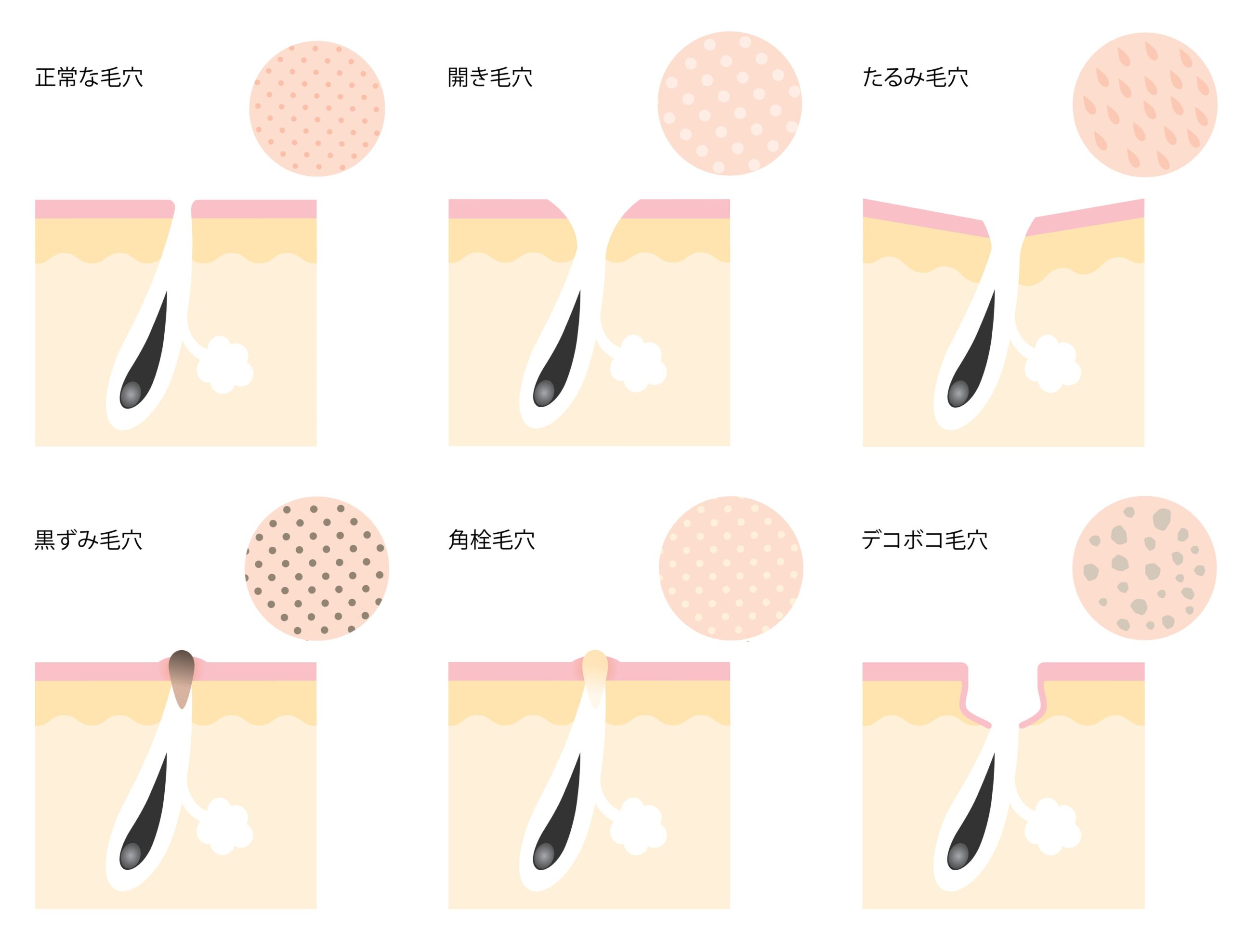 ハイドラジェントルとは