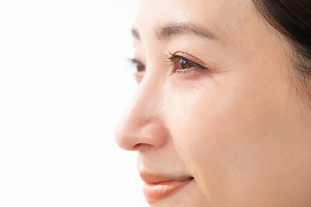 笑ったときにできる目元の小じわを目立たなくする