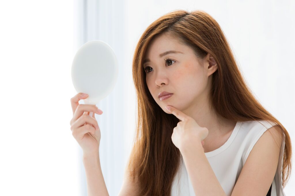 原因3：ホルモンバランスの乱れによる皮脂の過剰分泌