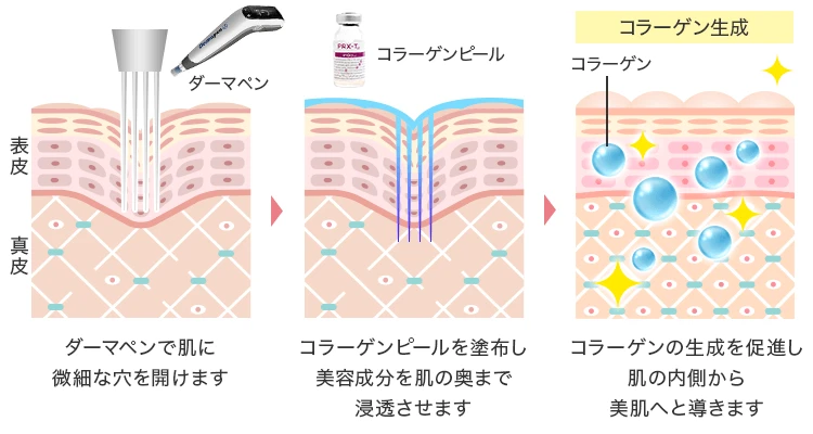 コラーゲン生成