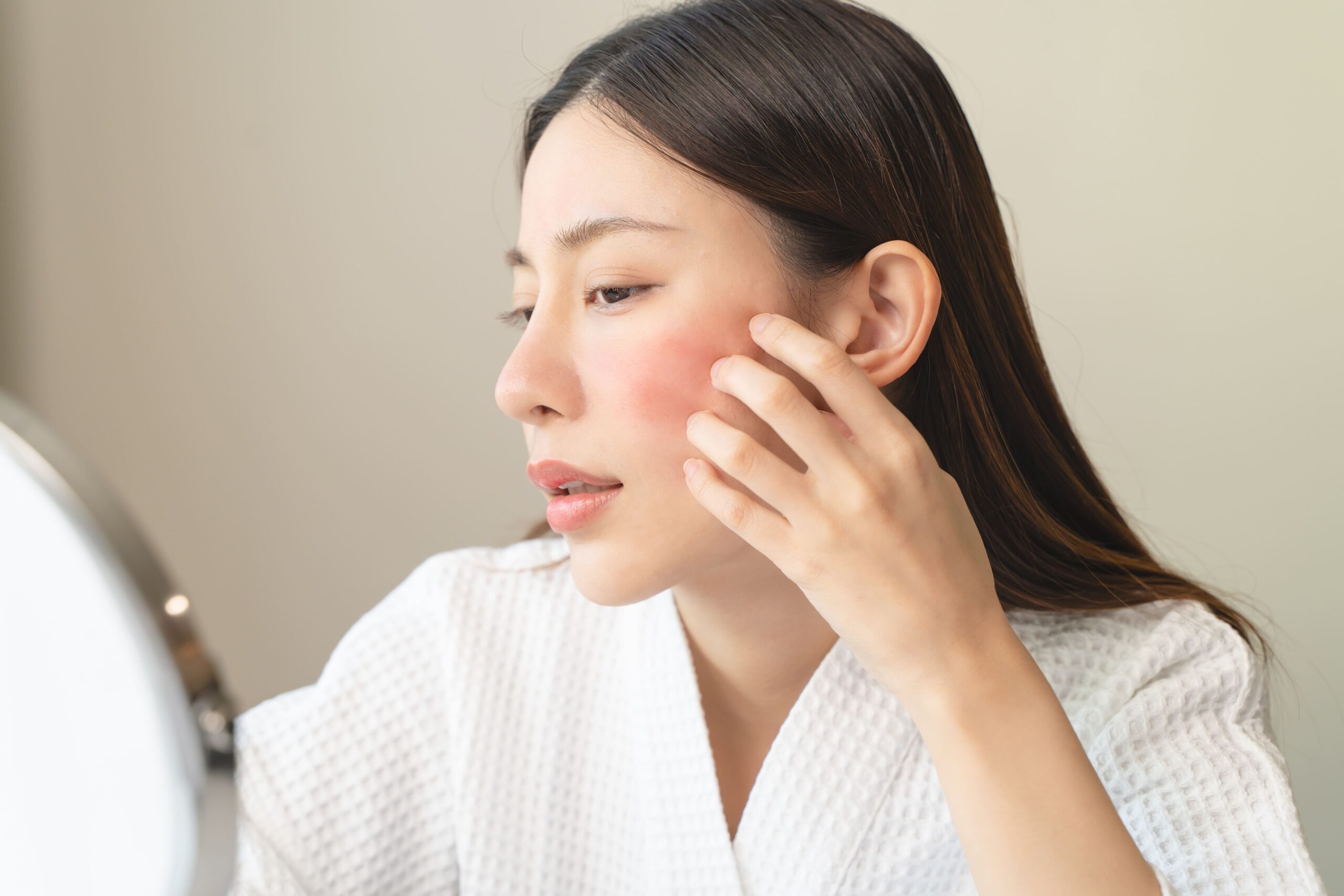 赤みを繰り返す顔アトピーに。「再生医療（ACRS）」という新しい治療とセルフケア