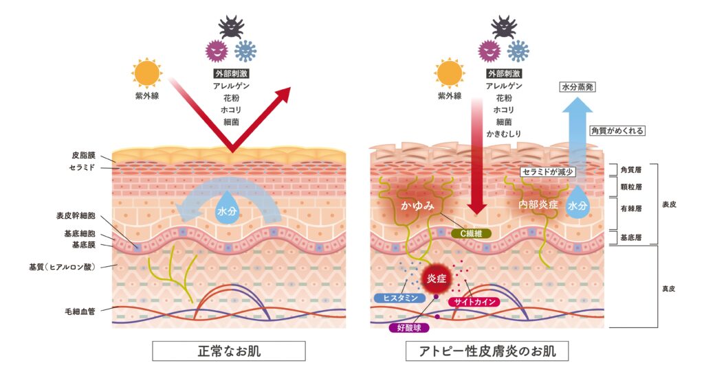 皮膚が薄く外部からの刺激を受けやすいため