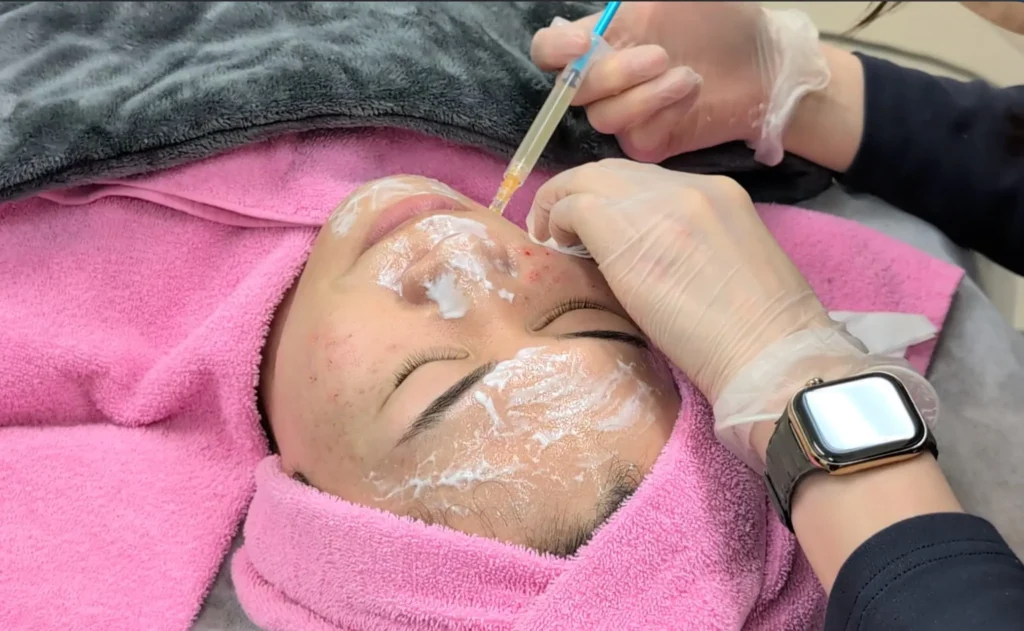 機械ではなく、肌状態に合わせた手打ち注入