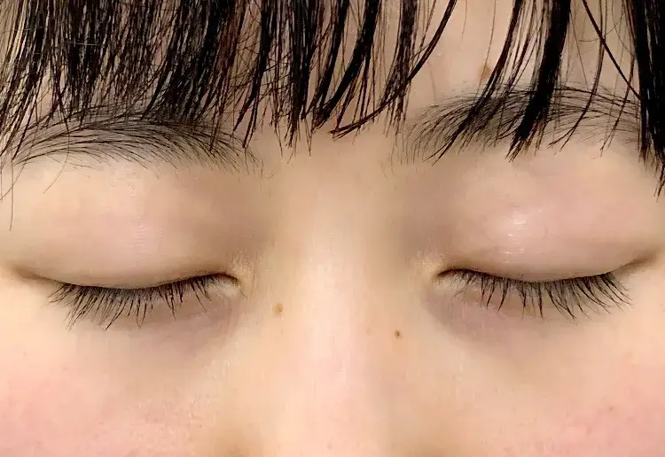 Before画像