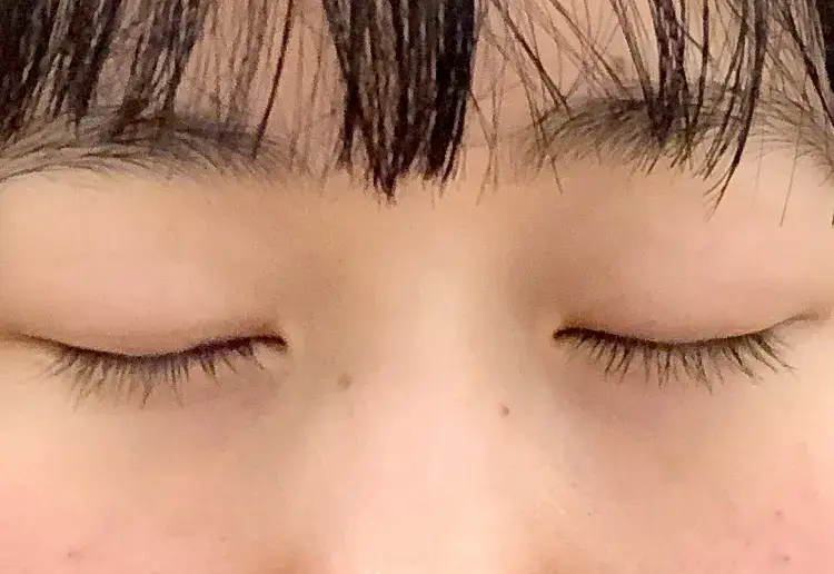 After画像